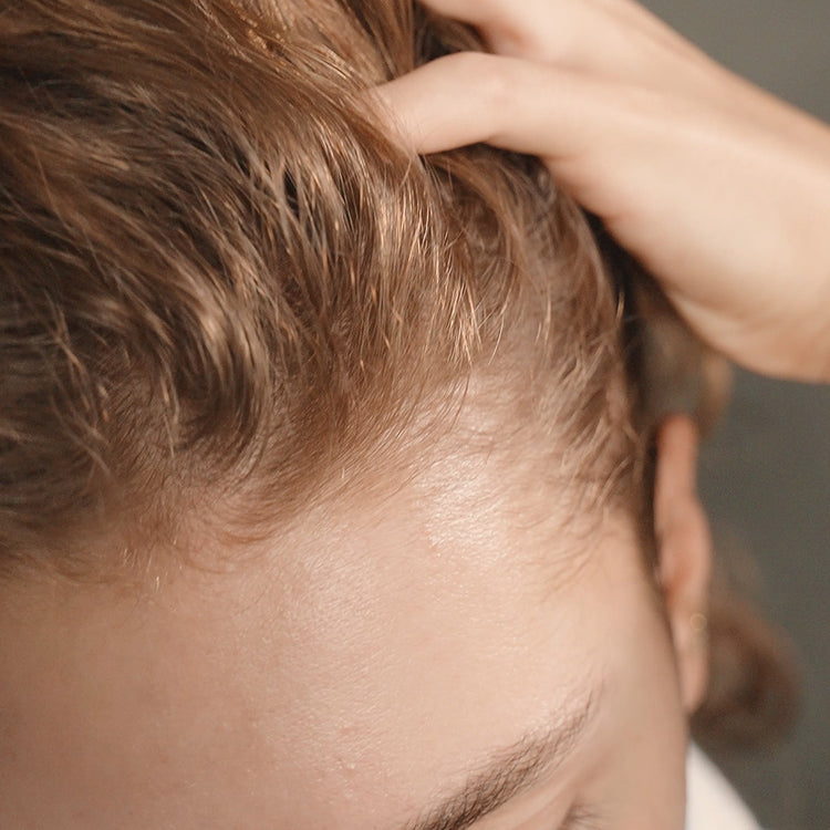 Hair Shedding and Hair Thinning: The Difference
